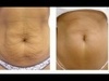 Nadera Beauty Center Amman - Jordan